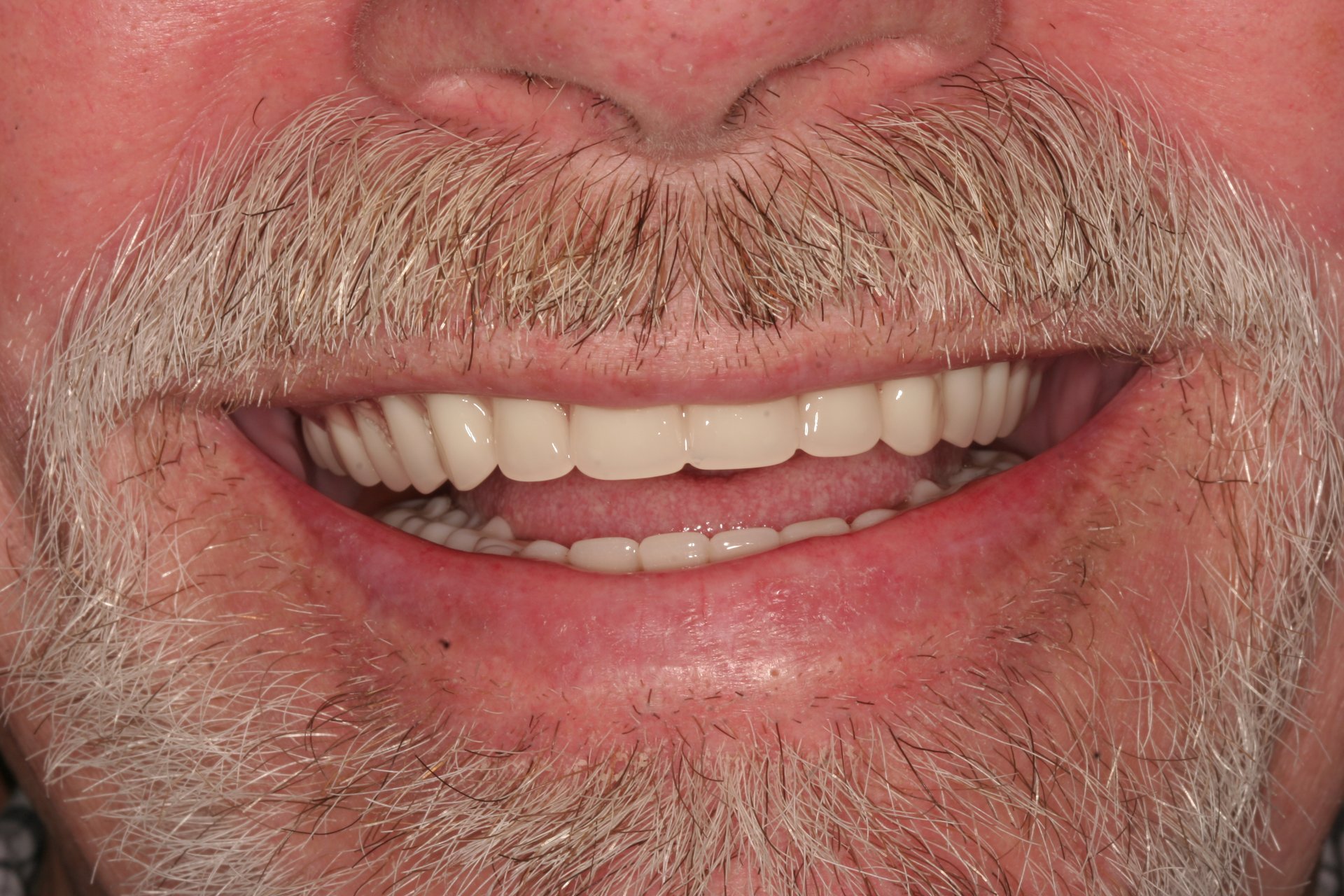 Man wearing dentures from Billings MT dentist