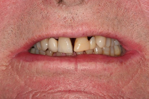 Dr. Johnson restorative dentist photos